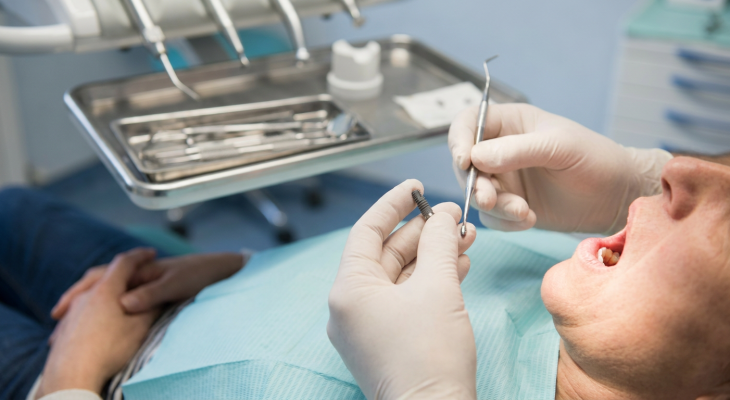 Impianto dentale Arezzo: guida pratica all’implantologia